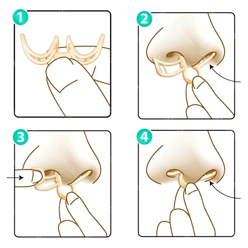 Comfortable Anti-Snoring Device for Restful Sleep