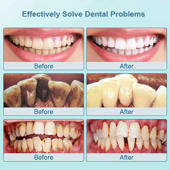 Electric Sonic Toothbrush