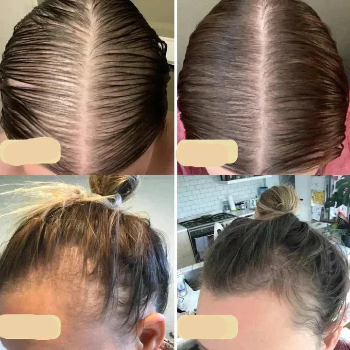 Vegan Hair Growth Oil Natural Booster for Healthy Hair Growth
