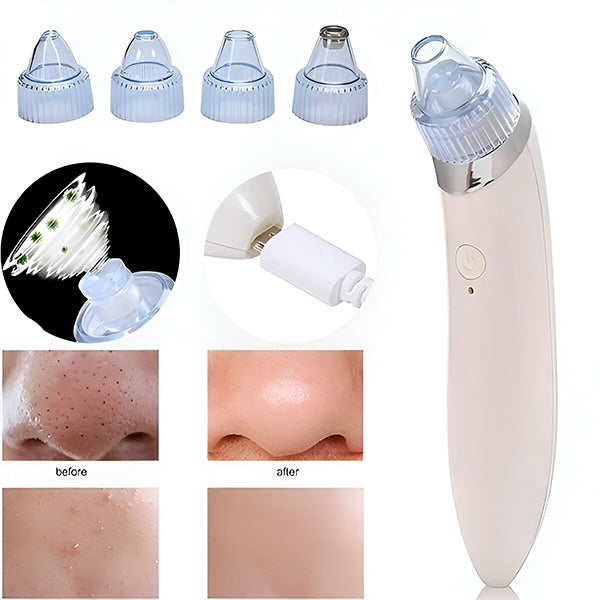 2-in-1 Pore Cleaner And Microdermabrasion Device