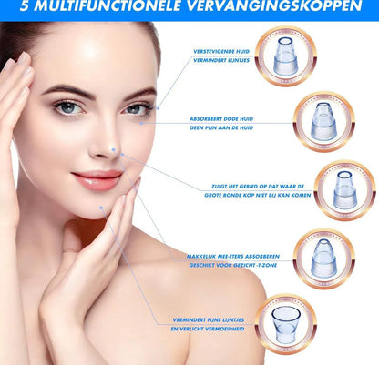 Electric Blackhead Remover
