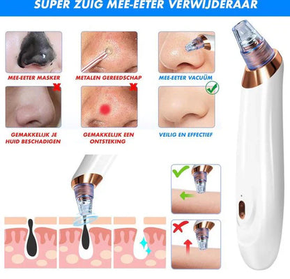 Electric Blackhead Remover