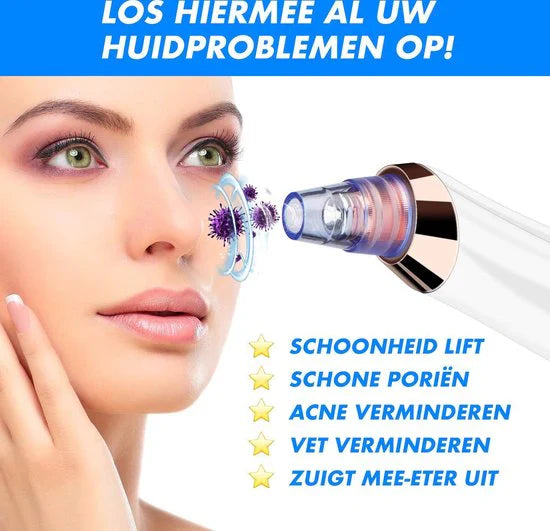 Electric Blackhead Remover