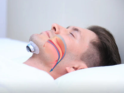 Electronic Anti-Snoring Device for Better Sleep