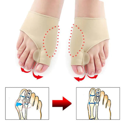 Hallux Valgus Correction Protection (1 Pair)
