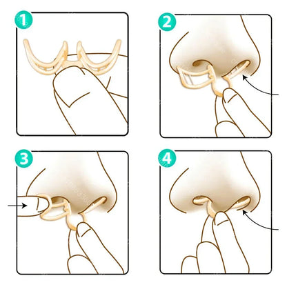 Comfortable Anti-Snoring Device for Restful Sleep