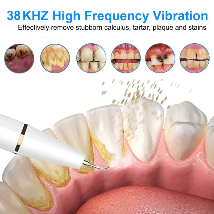 Electric Sonic Toothbrush