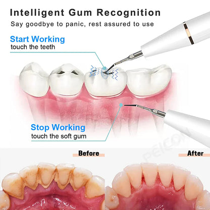 Electric Sonic Toothbrush