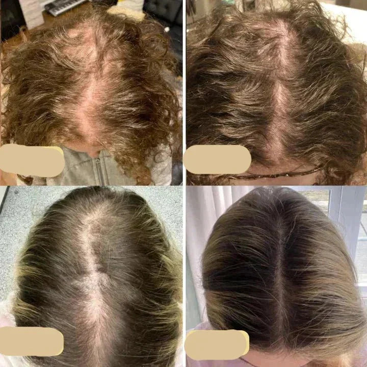 Vegan Hair Growth Oil Natural Booster for Healthy Hair Growth