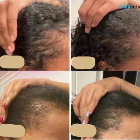 Vegan Hair Growth Oil Natural Booster for Healthy Hair Growth